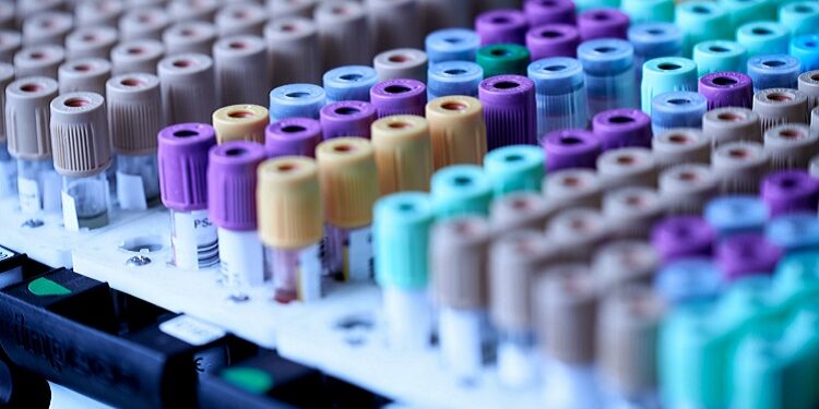 Vaccini e tamponi. Chi rischia cosa?